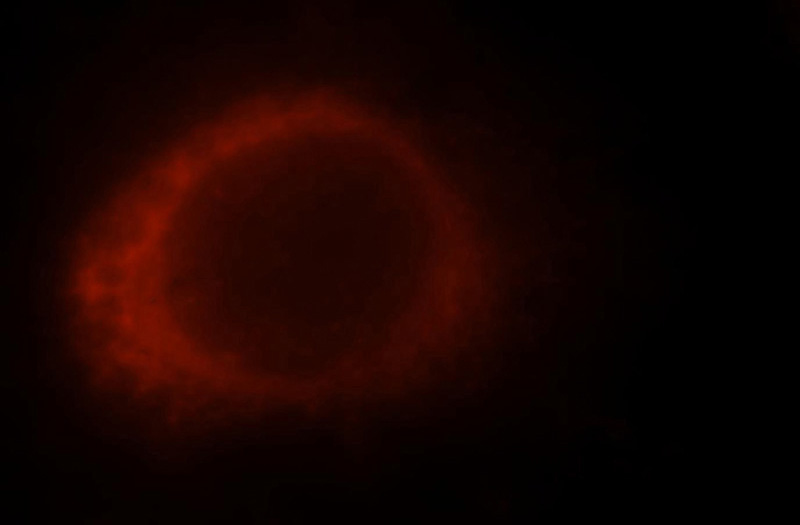 Immunofluorescent analysis of MCF-7 cells, using SRP14 antibody Catalog No:115590 at 1:25 dilution and Rhodamine-labeled goat anti-rabbit IgG (red).