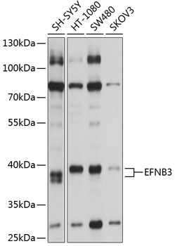 Western blot - EFNB3 Polyclonal Antibody 