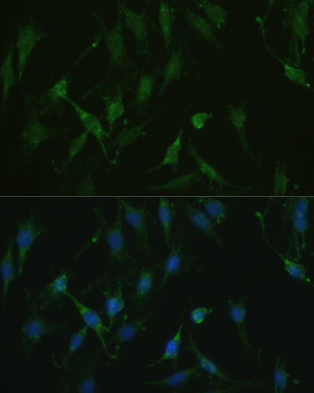 Immunofluorescence - TRPV1 Polyclonal Antibody 