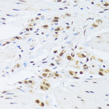 Immunohistochemistry - GABPB1 Polyclonal Antibody 