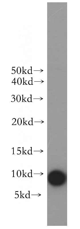 human spleen tissue were subjected to SDS PAGE followed by western blot with Catalog No:109004(CCL28 antibody) at dilution of 1:300