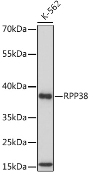 Western blot - RPP38 Polyclonal Antibody 