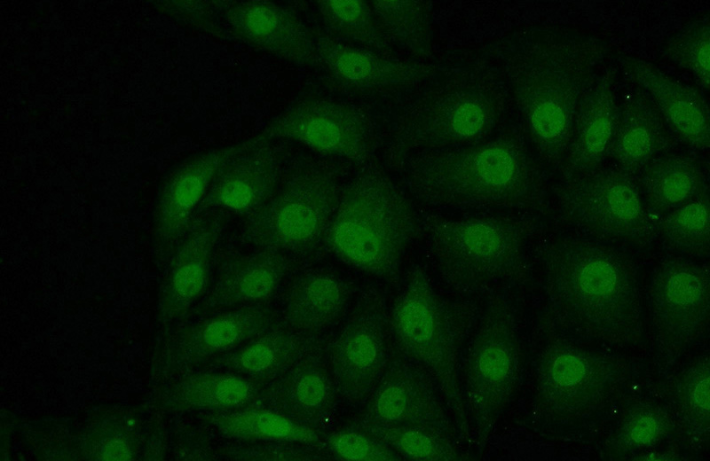 Immunofluorescent analysis of SH-SY5Y cells using Catalog No:112366(MAD1L1 Antibody) at dilution of 1:50 and Alexa Fluor 488-congugated AffiniPure Goat Anti-Rabbit IgG(H+L)