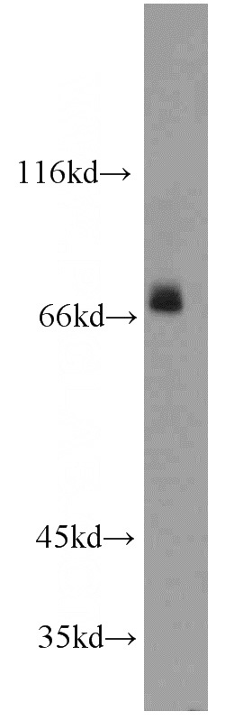 mouse skeletal muscle tissue were subjected to SDS PAGE followed by western blot with Catalog No:113791(PGM2L1 antibody) at dilution of 1:800