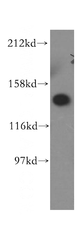 HL-60 cells were subjected to SDS PAGE followed by western blot with Catalog No:116703(VARS antibody) at dilution of 1:500