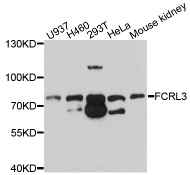 Western blot - FCRL3 Polyclonal Antibody 