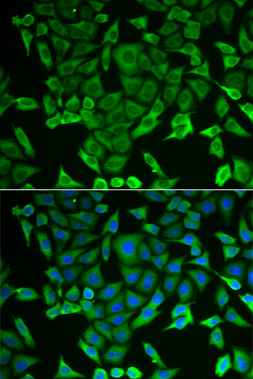 Immunofluorescence - RARS Polyclonal Antibody 