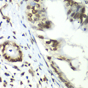 Immunohistochemistry - TEAD1 Polyclonal Antibody 