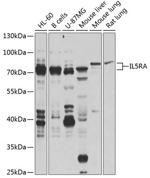 Western blot - IL5RA Polyclonal Antibody 