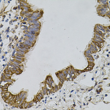 Immunohistochemistry - ARHGEF11 Polyclonal Antibody 