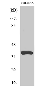 Fig1:; Western Blot analysis of various cells using Olfactory receptor 52B2 Polyclonal Antibody