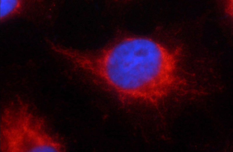 Immunofluorescent analysis of HUVEC cells using Catalog No:107321(NAPSA Antibody) at dilution of 1:25 and Rhodamine-Goat anti-Mouse IgG