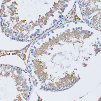 Immunohistochemistry - TNFSF12 Polyclonal Antibody 