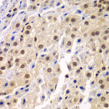Immunohistochemistry - SF3B2 Polyclonal Antibody 