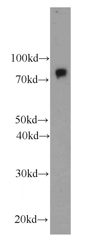 human blood tissue were subjected to SDS PAGE followed by western blot with Catalog No:107562(AFM antibody) at dilution of 1:500