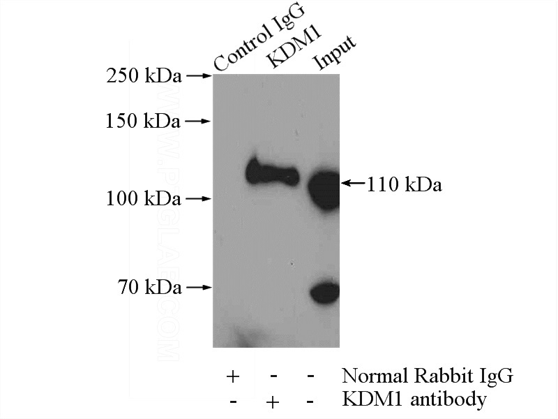 IP Result of anti-KDM1 (IP:Catalog No:112023, 4ug; Detection:Catalog No:112023 1:600) with HeLa cells lysate 2000ug.