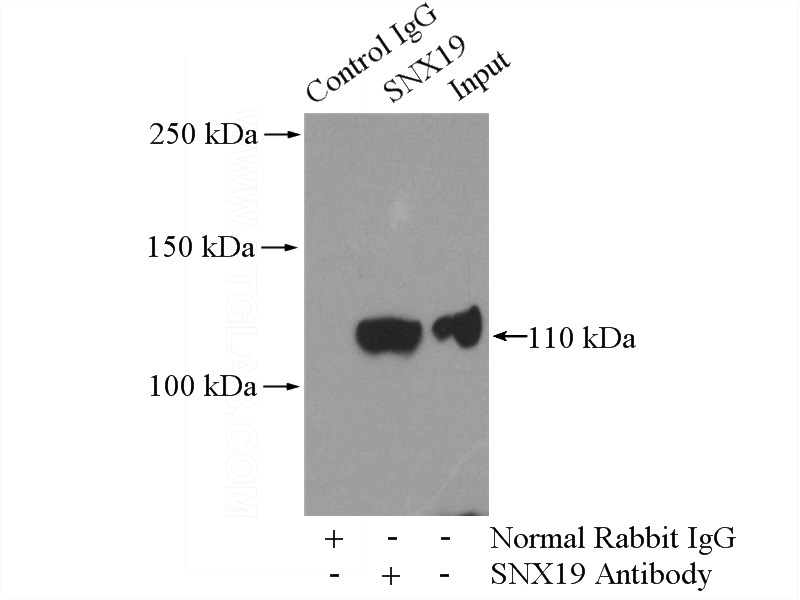 IP Result of anti-SNX19 (IP:Catalog No:115474, 4ug; Detection:Catalog No:115474 1:500) with Raji cells lysate 1600ug.