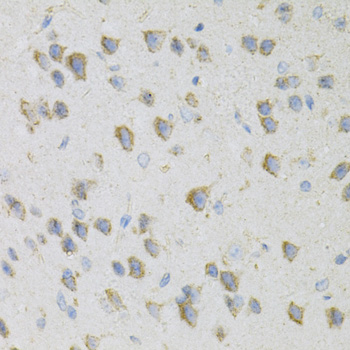 Immunohistochemistry - CDA Polyclonal Antibody 