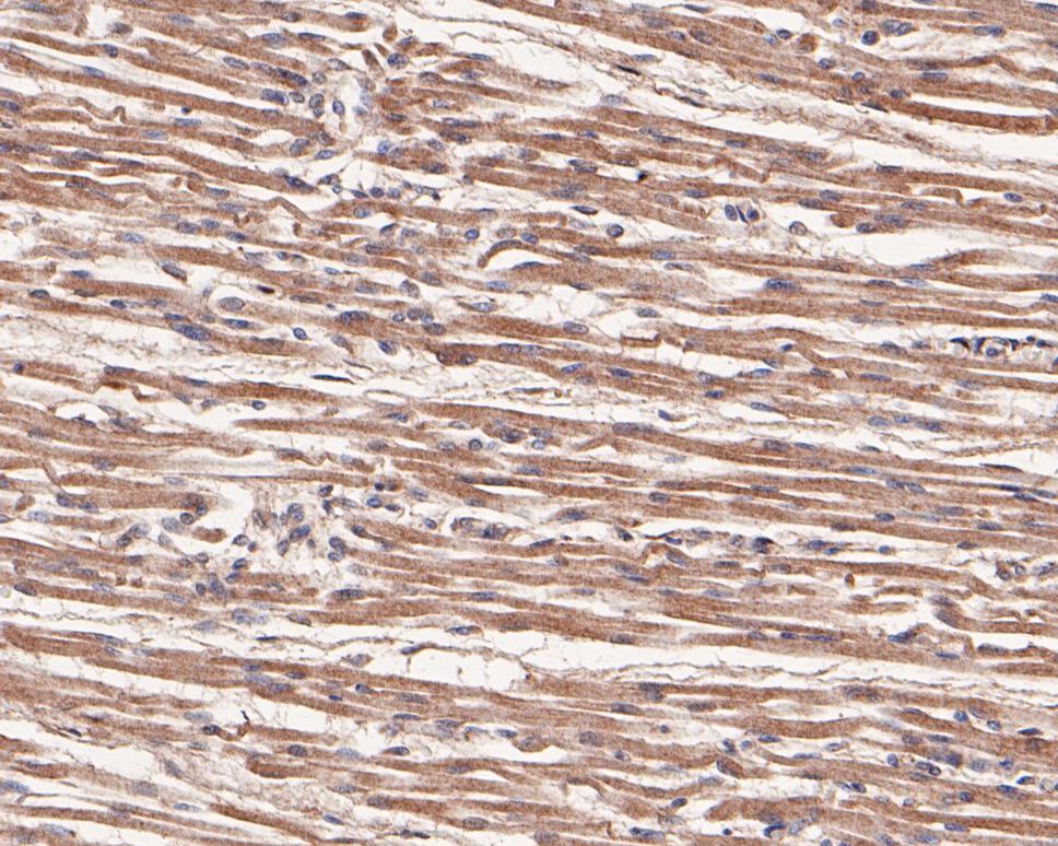 Fig4:; Immunohistochemical analysis of paraffin-embedded human skeletal muscle tissue using anti-VLDL Receptor antibody. The section was pre-treated using heat mediated antigen retrieval with Tris-EDTA buffer (pH 8.0-8.4) for 20 minutes.The tissues were blocked in 5% BSA for 30 minutes at room temperature, washed with ddH; 2; O and PBS, and then probed with the primary antibody ( 1/100) for 30 minutes at room temperature. The detection was performed using an HRP conjugated compact polymer system. DAB was used as the chromogen. Tissues were counterstained with hematoxylin and mounted with DPX.