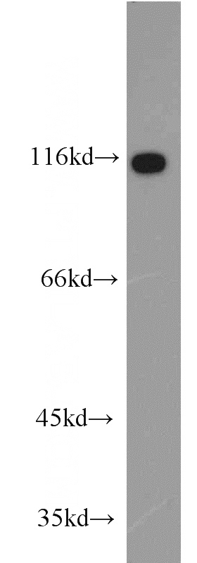 HEK-293 cells were subjected to SDS PAGE followed by western blot with Catalog No:108182(ARHGEF1 antibody) at dilution of 1:1000