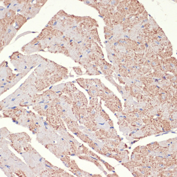 Immunohistochemistry - ADRA1A Polyclonal Antibody 