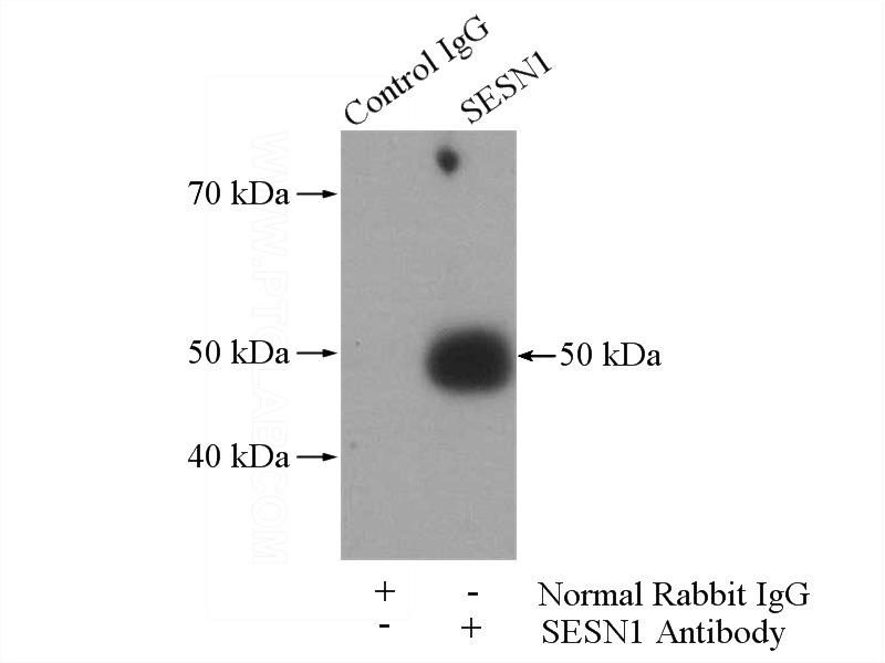 IP Result of anti-SESN1 (IP:Catalog No:115213, 4ug; Detection:Catalog No:115213 1:500) with mouse brain tissue lysate 3440ug.