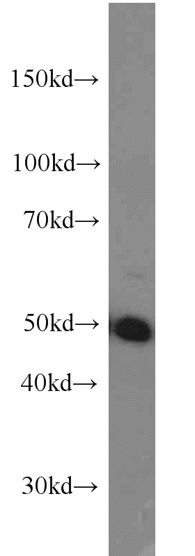 SKOV-3 cells were subjected to SDS PAGE followed by western blot with Catalog No:113609(PAX8 antibody) at dilution of 1:1000