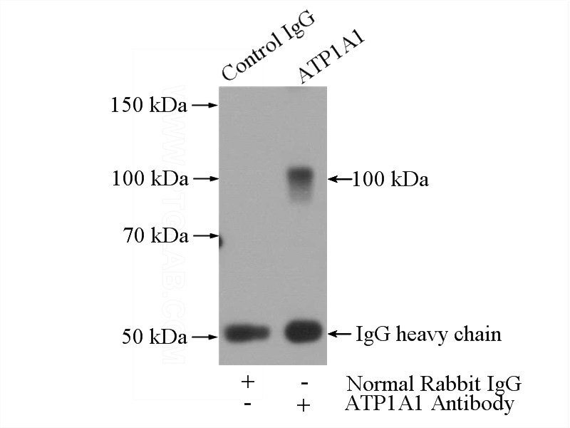 IP Result of anti-ATP1A1 (IP:Catalog No:117301, 4ug; Detection:Catalog No:117301 1:300) with HEK-293 cells lysate 2800ug.
