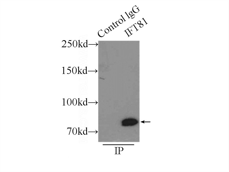 IP Result of anti-IFT81 (IP:Catalog No:111673, 3ug; Detection:Catalog No:111673 1:500) with mouse brain tissue lysate 7500ug.