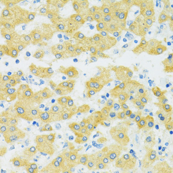 Immunohistochemistry - SLC37A4 Polyclonal Antibody 