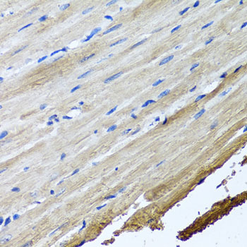 Immunohistochemistry - TTLL12 Polyclonal Antibody 