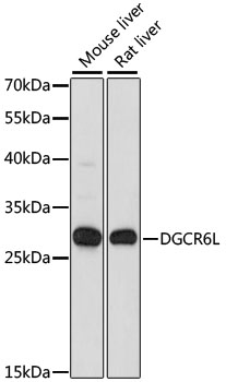 Western blot - DGCR6L Polyclonal Antibody 