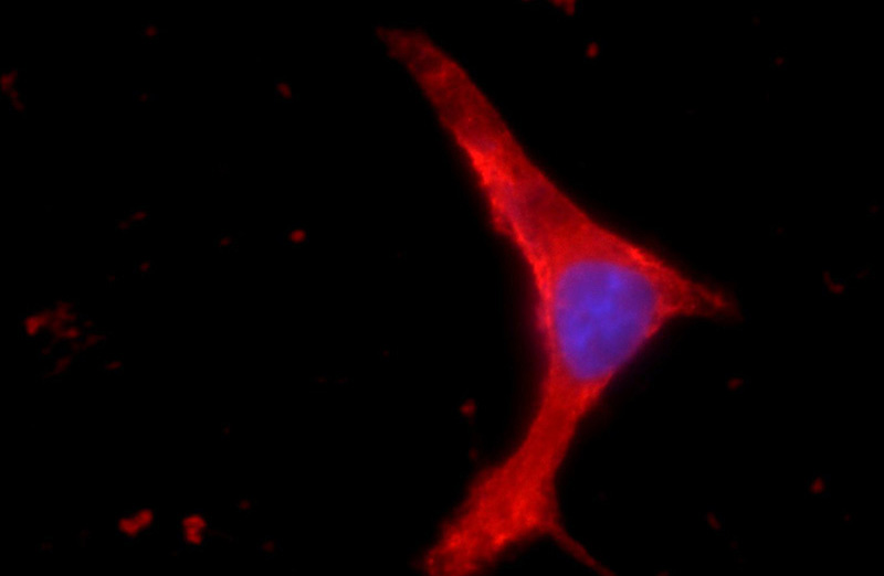 Immunofluorescent analysis of SH-SY5Y cells using Catalog No:111926(KCNB1-Specific Antibody) at dilution of 1:25 and Rhodamine-Goat anti-Rabbit IgG