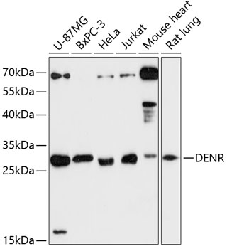 Western blot - DENR Polyclonal Antibody 