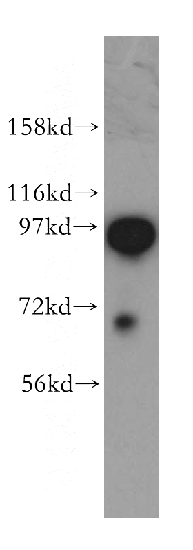 K-562 cells were subjected to SDS PAGE followed by western blot with Catalog No:109458(COPG antibody) at dilution of 1:500