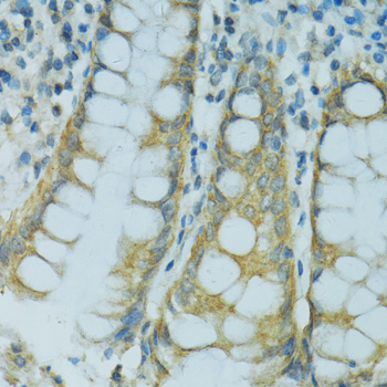 Immunohistochemistry - CYP2B6 Polyclonal Antibody 