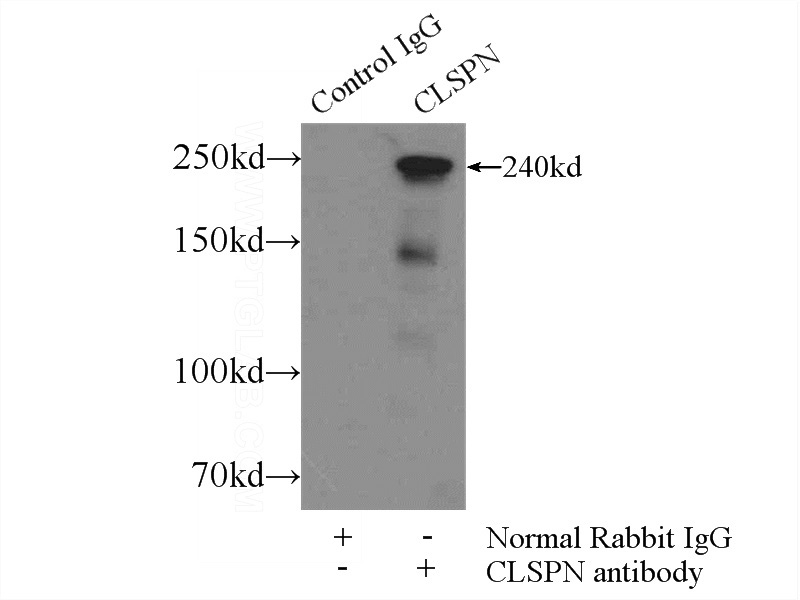 IP Result of anti-CLSPN (IP:Catalog No:109335, 5ug; Detection:Catalog No:109335 1:1000) with HEK-293 cells lysate 2400ug.