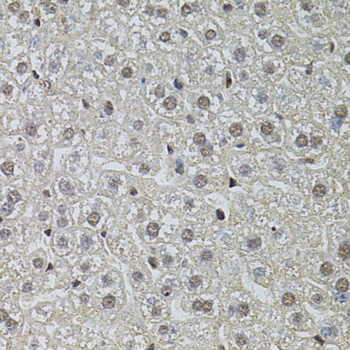 Immunohistochemistry - POP4 Polyclonal Antibody 