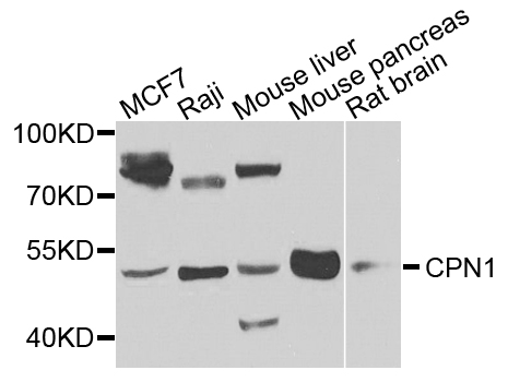 Western blot - CPN1 Polyclonal Antibody 