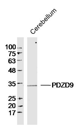 Fig1: Sample: Cerebellum (Mouse) Lysate at 40 ug; Primary: Anti-PDZD9 at 1/300 dilution; Secondary: IRDye800CW Goat Anti-Rabbit IgG at 1/20000 dilution; Predicted band size: 30kD; Observed band size: 30kD