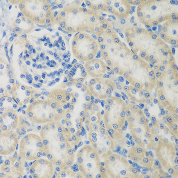 Immunohistochemistry - CCL26 Polyclonal Antibody 