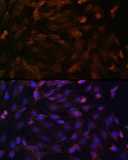 Immunofluorescence - PTCH1 Polyclonal Antibody 