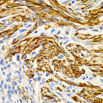 Immunohistochemistry - EDA Polyclonal Antibody 