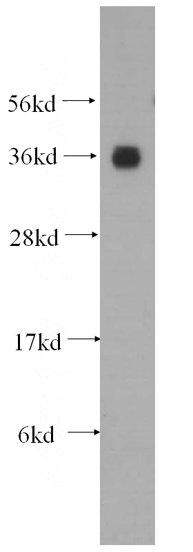 HeLa cells were subjected to SDS PAGE followed by western blot with Catalog No:107938(AKR1A1 antibody) at dilution of 1:500