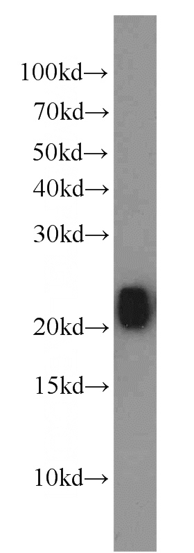 mouse brain tissue were subjected to SDS PAGE followed by western blot with Catalog No:114658(RHOB antibody) at dilution of 1:2000