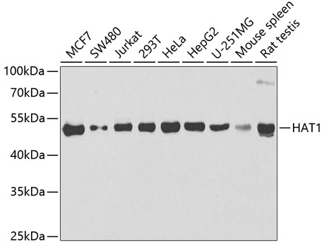 Western blot - HAT1 Polyclonal Antibody 