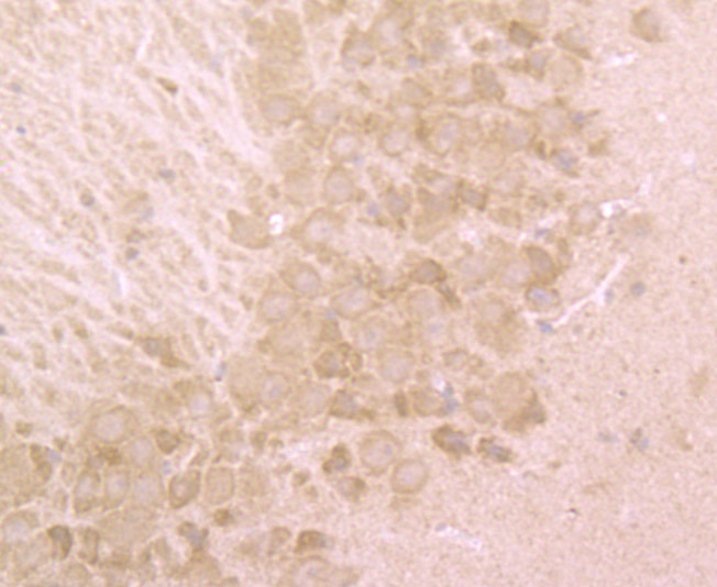 Fig4: Immunohistochemical analysis of paraffin-embedded mouse brain tissue using anti-BHLHB9 antibody. Counter stained with hematoxylin.