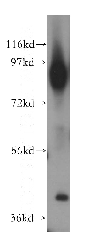 human heart tissue were subjected to SDS PAGE followed by western blot with Catalog No:111589(ICAM-1 antibody) at dilution of 1:500