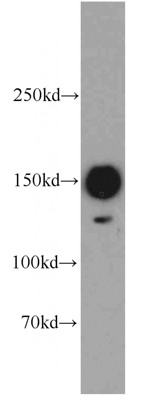 HT-1080 cells were subjected to SDS PAGE followed by western blot with Catalog No:110470(FAM129A antibody) at dilution of 1:500