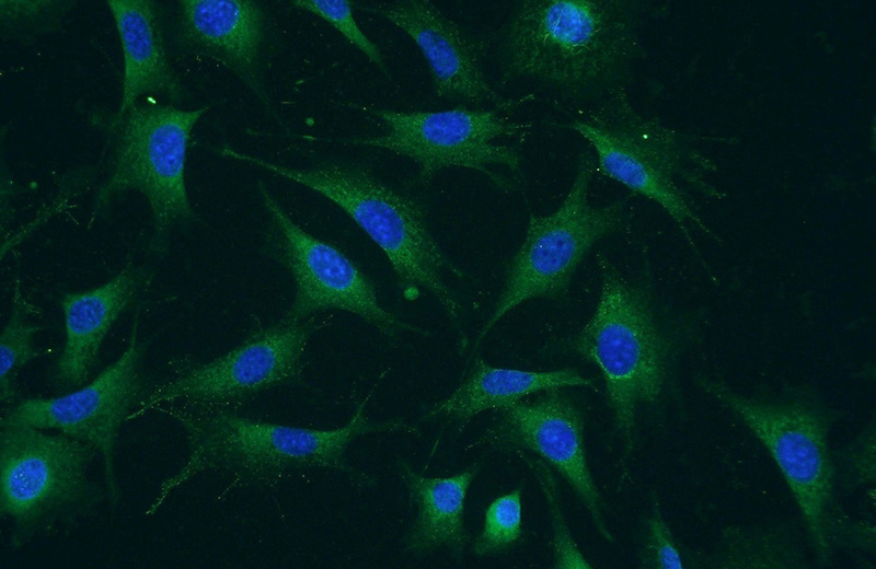 Immunofluorescent analysis of NIH/3T3 cells using Catalog No:108323(ATPBD4 Antibody) at dilution of 1:50 and Alexa Fluor 488-congugated AffiniPure Goat Anti-Rabbit IgG(H+L)